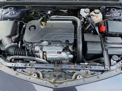 2025 Chevrolet Malibu LT 1LT