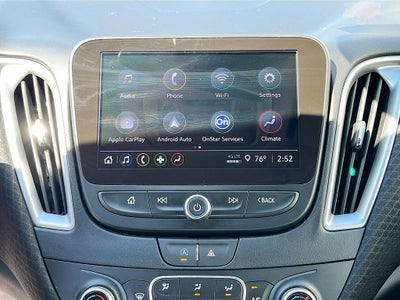 2025 Chevrolet Malibu LT 1LT
